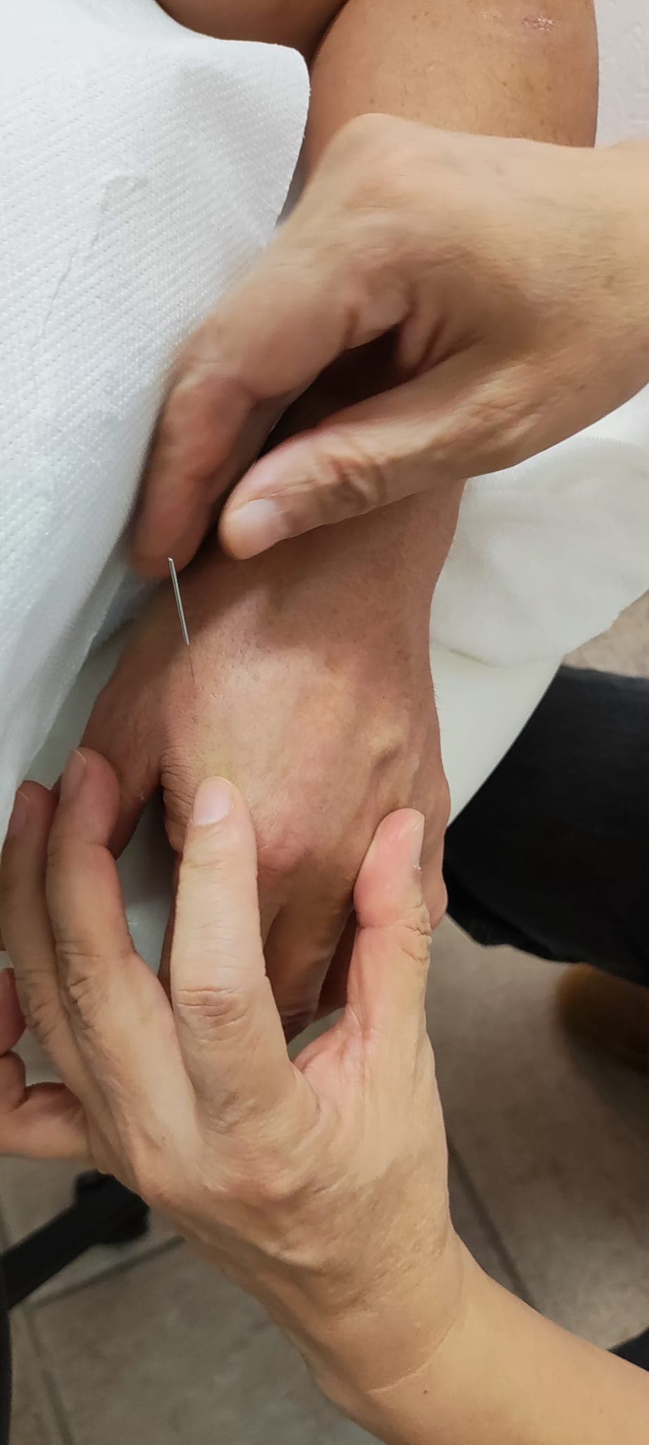 Sfeerbeeld bij Moxibustie